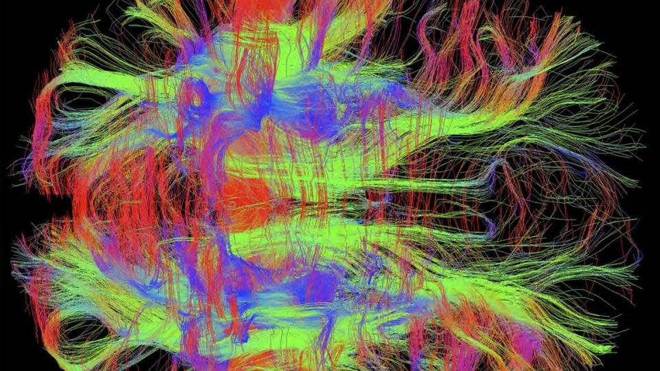 Pohled shora na nervy ve zdravém lidském mozku pomocí technologie DWI MRI